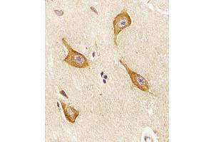 Immunohistochemical analysis of paraffin-embedded H.