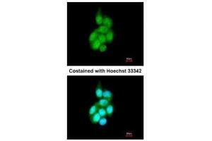 ICC/IF Image Immunofluorescence analysis of methanol-fixed A431, using BAIAP2L1, antibody at 1:200 dilution. (BAIAP2L1 anticorps)