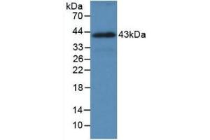 Detection of Recombinant HSPA1A, Human using Monoclonal Antibody to Heat Shock 70 kDa Protein 1A (HSPA1A) (HSP70 1A anticorps  (AA 285-641))