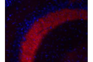 anti-Mal, T Cell Differentiation Protein 2 (MAL2) (AA 13-21) antibody