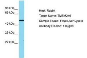 Image no. 1 for anti-Transmembrane Protein 246 (TMEM246) (AA 152-201) antibody (ABIN6750482) (TMEM246 anticorps  (AA 152-201))