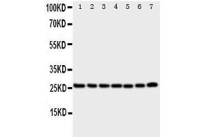 Western Blotting (WB) image for anti-Calcyclin Binding Protein (CACYBP) (AA 160-175), (Middle Region) antibody (ABIN3044149)