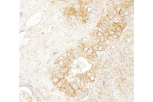Immunohistochemistry (IHC) image for anti-Catenin, beta (CATNB) (AA 760-781) antibody (ABIN7448432)