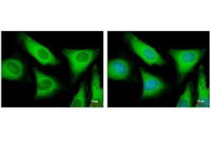 ICC/IF Image EIF2 beta antibody detects EIF2S2 protein at cytoplasm by immunofluorescent analysis. (EIF2S2 anticorps)