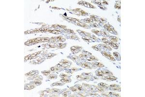Immunohistochemistry of paraffin-embedded mouse stomach using IER3 antibody at dilution of 1:100 (x40 lens).