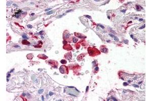 Image no. 1 for anti-Ionized Calcium-binding Adapter Molecule 1 (IBA1) (C-Term) antibody (ABIN492698) (Iba1 anticorps  (C-Term))