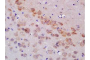 Formalin-fixed and paraffin embedded rat brain labeled with Rabbit Anti-GLUR3 Polyclonal Antibody, Unconjugated  at 1:200 followed by conjugation to the secondary antibody and DAB staining (Glutamate Receptor 3 anticorps  (AA 451-550))