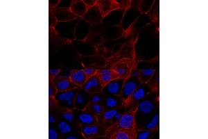 Confocal immunofluorescence analysis of  cells using CD44 antibody (ABIN6127602, ABIN6138193, ABIN6138195 and ABIN7101398) at dilution of 1:200.