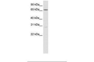Image no. 1 for anti-Nuclear Factor of Activated T-Cells 5, Tonicity-Responsive (NFAT5) (C-Term) antibody (ABIN6736082) (NFAT5 anticorps  (C-Term))