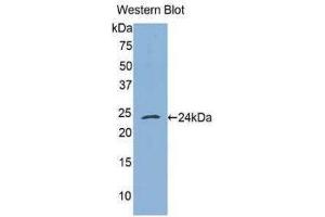 Western Blotting (WB) image for anti-Tumor Necrosis Factor Receptor Superfamily, Member 1A (TNFRSF1A) (AA 257-458) antibody (ABIN1860802)