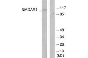 Western blot analysis of extracts from Jurkat cells, using NMDAR1 (Ab-897) Antibody. (GRIN1/NMDAR1 anticorps  (AA 864-913))