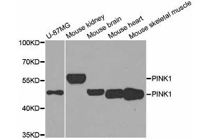 Western blot analysis of extracts of various cell lines, using PINK1 antibody (ABIN5974289) at 1/1000 dilution. (PINK1 anticorps)