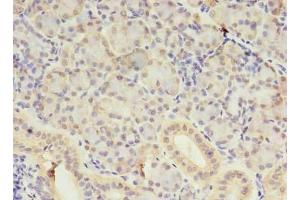 Immunohistochemistry of paraffin-embedded human pancreatic tissue using ABIN7170741 at dilution of 1:100 (SAMD3 anticorps  (AA 62-197))