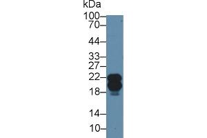 Western blot analysis of Human A549 cell lysate, using Rabbit Anti-Human CAV1 Antibody (2 µg/ml) and HRP-conjugated Goat Anti-Rabbit antibody (abx400043, 0. (Caveolin-1 anticorps  (AA 2-104))