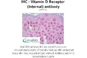 Image no. 1 for anti-Vitamin D Receptor (VDR) (Internal Region) antibody (ABIN1740731) (Vitamin D Receptor anticorps  (Internal Region))