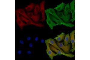 ABIN6257187 and ABIN6273849 staining Hela cells by IF/ICC.