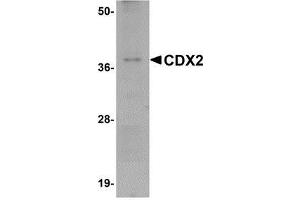 Western blot analysis of CDX2 in mouse brain tissue lysate with AP30223PU-N CDX2 antibody at 1 μg/ml. (CDX2 anticorps  (C-Term))