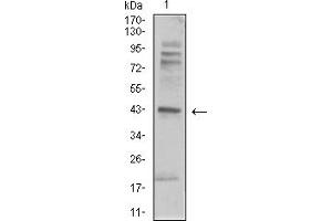 Western Blotting (WB) image for anti-Adrenergic, beta-2-, Receptor, Surface (ADRB2) (AA 302-413) antibody (ABIN5911929) (beta 2 Adrenergic Receptor anticorps  (AA 302-413))