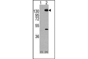 Image no. 1 for anti-Platelet Derived Growth Factor Receptor alpha (PDGFRA) (Tyr768) antibody (ABIN359912) (PDGFRA anticorps  (Tyr768))
