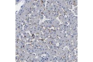 Immunohistochemical staining of human liver with CLEC4G polyclonal antibody  shows distinct positivity in sinusoids. (CLEC4G anticorps)