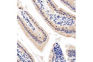 Immunohistochemistry of paraffin embedded mouse jejunum using SLC7A8 (ABIN7074503) at dilution of 1:1100 (400x lens)
