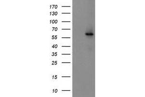 Western Blotting (WB) image for anti-Cytochrome P450, Family 2, Subfamily J, Polypeptide 2 (CYP2J2) antibody (ABIN1497730)