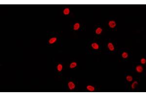 ABIN6269020 staining 293 by IF/ICC. (TBP anticorps  (N-Term))