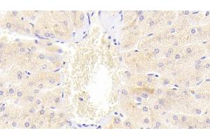 Detection of DR5 in Human Liver Tissue using Polyclonal Antibody to Death receptor 5 (DR5) (TNFRSF10B anticorps  (AA 234-435))