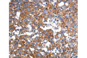 Immunohistochemistry (IHC) image for anti-Inner Membrane Protein, Mitochondrial (IMMT) (AA 120-270) antibody (ABIN3016602)
