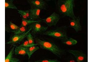 IF analysis of SNRNP40 and Tubulin beta using anti-SNRNP40 antibody (ABIN7601719) and anti-Tubulin beta antibody (ABIN7602744). (SNRNP40 anticorps  (AA 43-357))