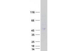 Validation with Western Blot