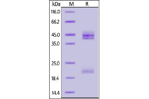 Cynomolgus IL-23A & Mouse IL-12B Heterodimer Protein, His Tag&Tag Free on  under reducing (R) condition. (IL12A & IL27B (AA 22-189) (Active) protein (His tag))