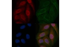 HNF1A Mouse Monoclonal Antibody staining Hela cells by IF/ICC.