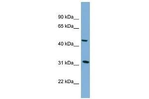 SERPINI2 antibody used at 1 ug/ml to detect target protein. (SERPINI2 anticorps)
