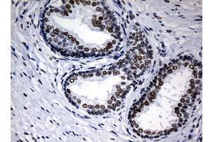 anti-Nibrin (NBN) (AA 461-754) antibody