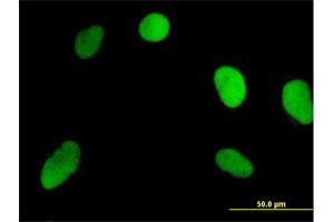 Immunofluorescence of purified MaxPab antibody to NOSIP on HeLa cell. (NOSIP anticorps  (AA 1-301))
