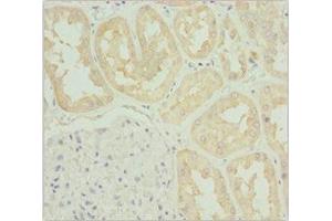 Immunohistochemistry of paraffin-embedded human kidney tissue using ABIN7171763 at dilution of 1:100 (TNS3 anticorps  (AA 1-240))