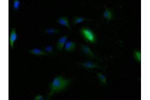 Immunofluorescence staining of U251 cells with ABIN7147821 at 1:150, counter-stained with DAPI. (Clarin 2 anticorps  (AA 31-100))