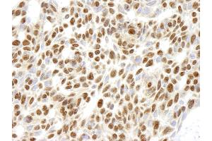 Immunohistochemistry (IHC) image for anti-Ribosomal Protein L26 (RPL26) (C-Term) antibody (ABIN7448782) (RPL26 anticorps  (C-Term))