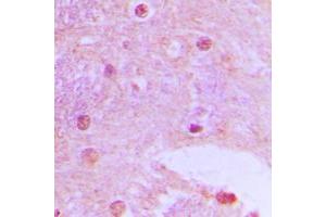 Immunohistochemical analysis of TAF6L staining in human brain formalin fixed paraffin embedded tissue section.