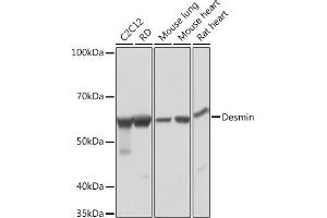 Western blot analysis of extracts of various cell lines, using Desmin Rabbit mAb (ABIN1678733, ABIN3018020, ABIN3018021 and ABIN7101569) at 1:1000 dilution.