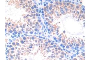 Detection of CYP21A2 in Mouse Testis Tissue using Polyclonal Antibody to Cytochrome P450 Family 21 Subfamily A Member 2 (CYP21A2)