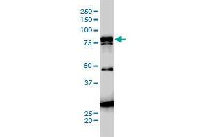 JUP monoclonal antibody (M01A), clone 1D5 Western Blot analysis of JUP expression in A-431 . (JUP anticorps  (AA 1-745))