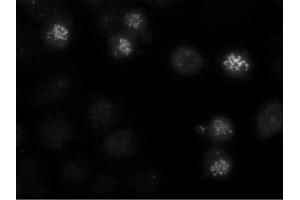 Image no. 1 for anti-Centromere Protein E, 312kDa (CENPE) antibody (ABIN341075) (CENPE anticorps)