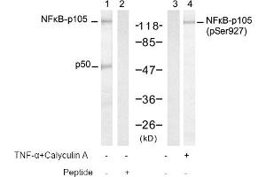 Image no. 1 for anti-Nuclear Factor of kappa Light Polypeptide Gene Enhancer in B-Cells 1 (NFKB1) (pSer927) antibody (ABIN319253) (NFKB1 anticorps  (pSer927))