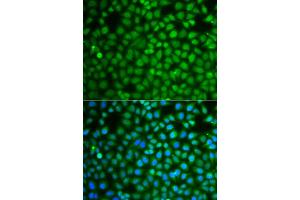 Immunofluorescence analysis of A549 cells using ZNF346 antibody (ABIN5975303). (ZNF346 anticorps)