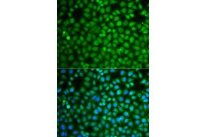 Immunofluorescence analysis of A549 cells using ZNF346 antibody (ABIN5975303). (ZNF346 anticorps)