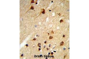Formalin-fixed and paraffin-embedded human brain tissue reacted with CENPK Antibody (C-term), which was peroxidase-conjugated to the secondary antibody, followed by DAB staining. (CENPK anticorps  (C-Term))