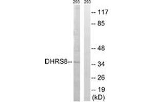 Western Blotting (WB) image for anti-Hydroxysteroid (17-Beta) Dehydrogenase 11 (HSD17B11) (AA 71-120) antibody (ABIN2890258) (HSD17B11 anticorps  (AA 71-120))