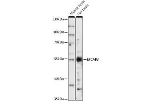 anti-EF-Hand Calcium Binding Domain 3 (EFCAB3) (AA 249-438) antibody